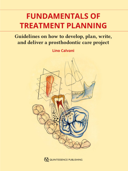 Fundamentals of Treatment Planning