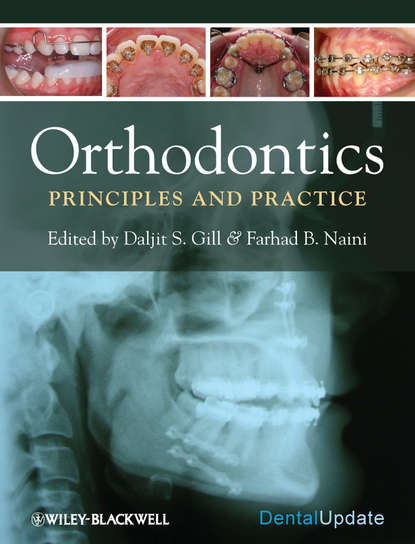 Orthodontics. Principles and Practice