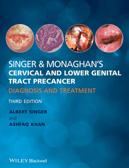 Singer & Monaghan's Cervical and Lower Genital Tract Precancer. Diagnosis and Treatment