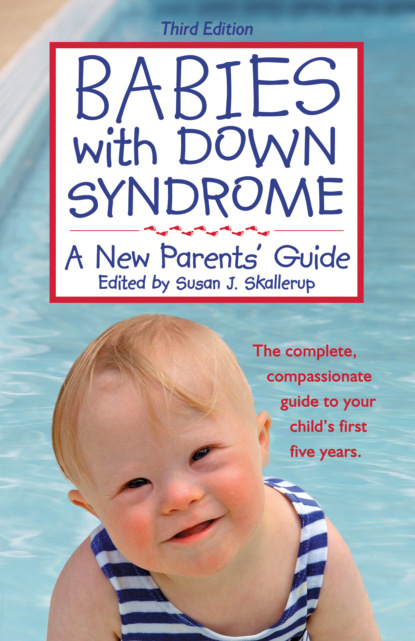Babies with Down Syndrome, Third Edition