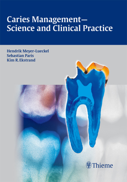 Caries Management - Science and Clinical Practice