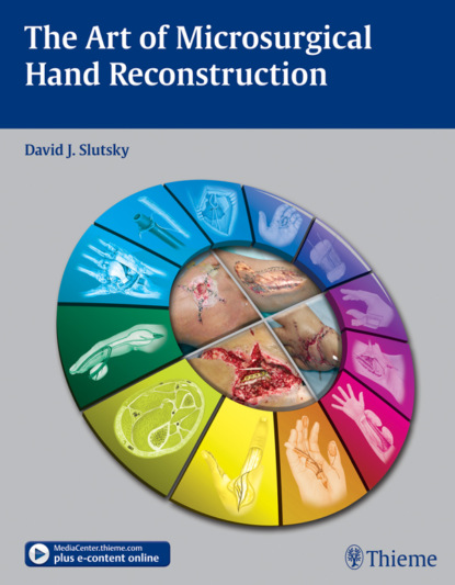 Art of Microsurgical Hand Reconstruction