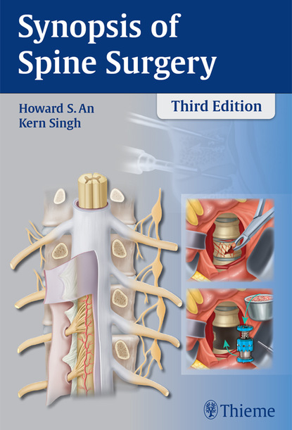 Synopsis of Spine Surgery