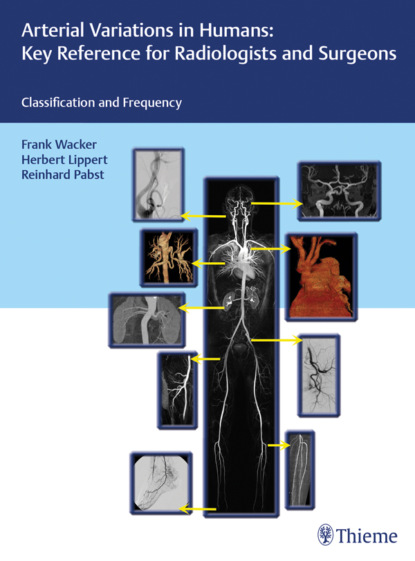 Arterial Variations in Humans: Key Reference for Radiologists and Surgeons