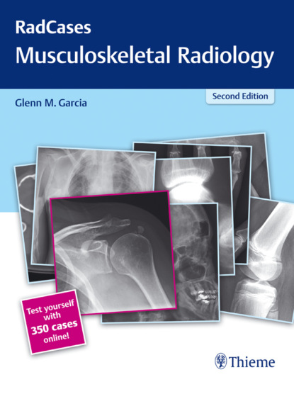 Radcases Musculoskeletal Radiology