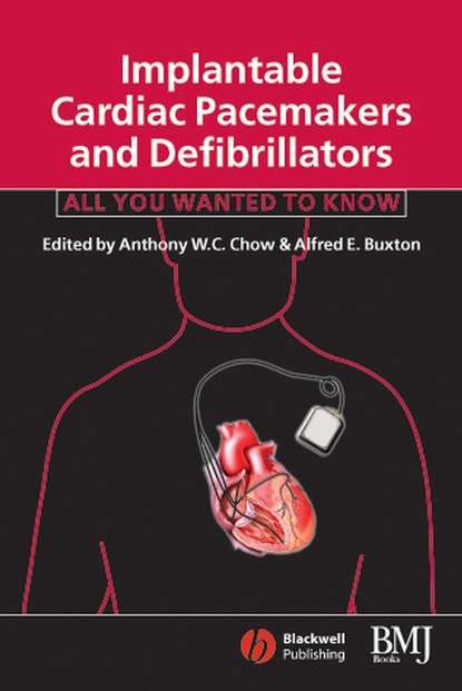 Implantable Cardiac Pacemakers and Defibrillators