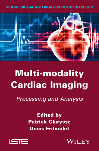 Multi-modality Cardiac Imaging